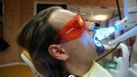 Bleichung in der Zahnarztpraxis mit Hilfe der Plasmalampe Rembrand Sapphire