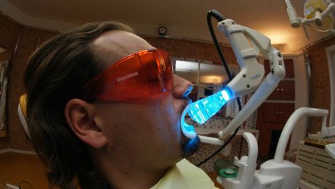 Bleichung in der Zahnarztpraxis mit Hilfe der Plasmalampe Rembrand Sapphire