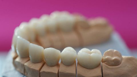 Physiologische Modellierung der Inzisionskanten